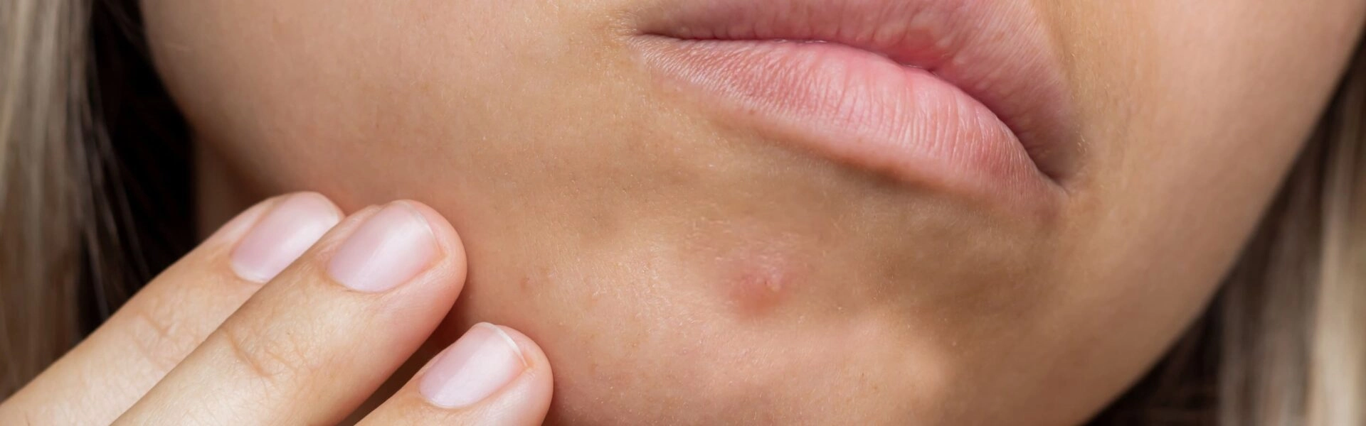 comment faire disparaitre un bouton URGO