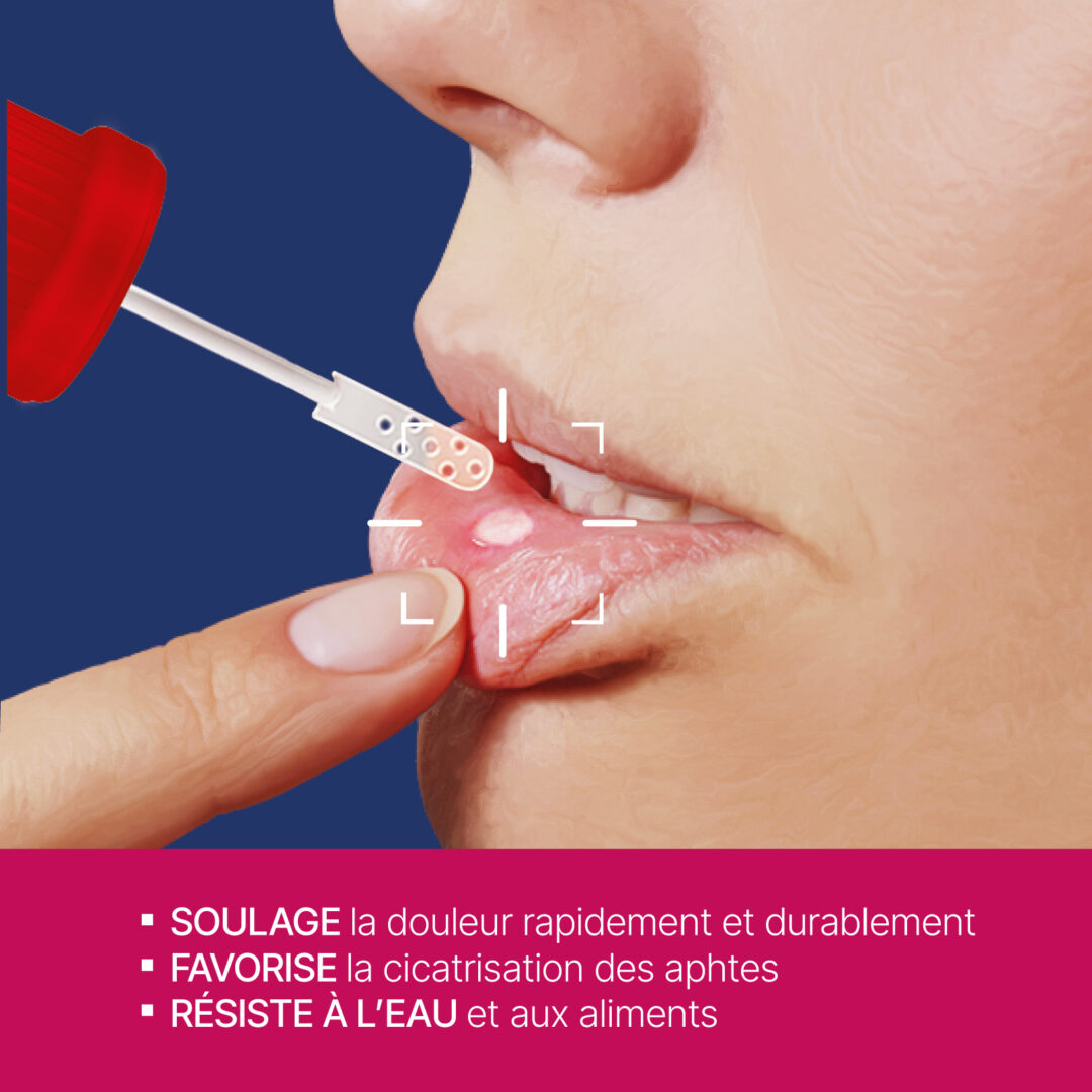 urgo aphtes plaies buccales soulage favorise cicatrisation