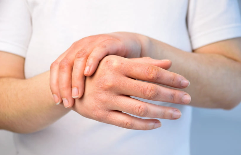 URGO-Comment prévenir et soigner les crevasses des mains et des pieds