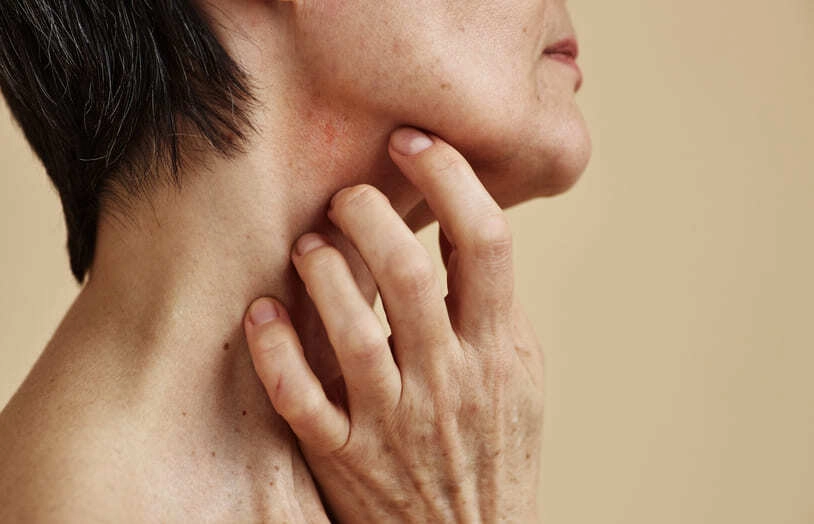 URGO-Peaux réactives