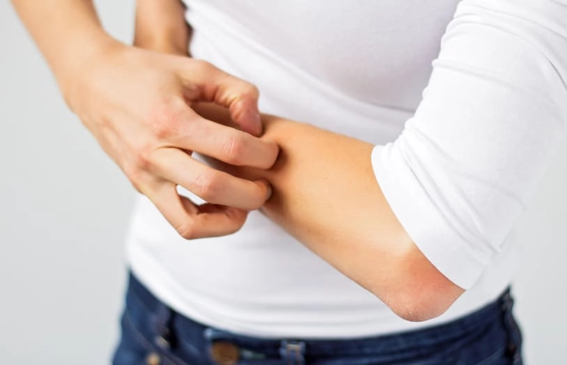 URGO-Que faire en cas de piqûres d'insectes