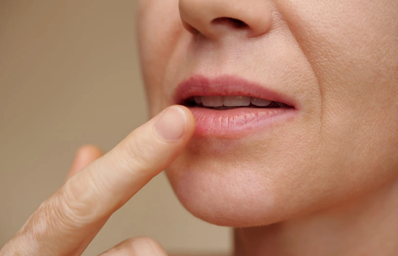 URGO - Fissures levres - causes preventions et solutions pour apaiser et soulager